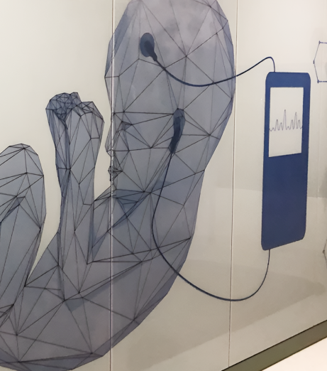 Seamless result wall surface with print on wall